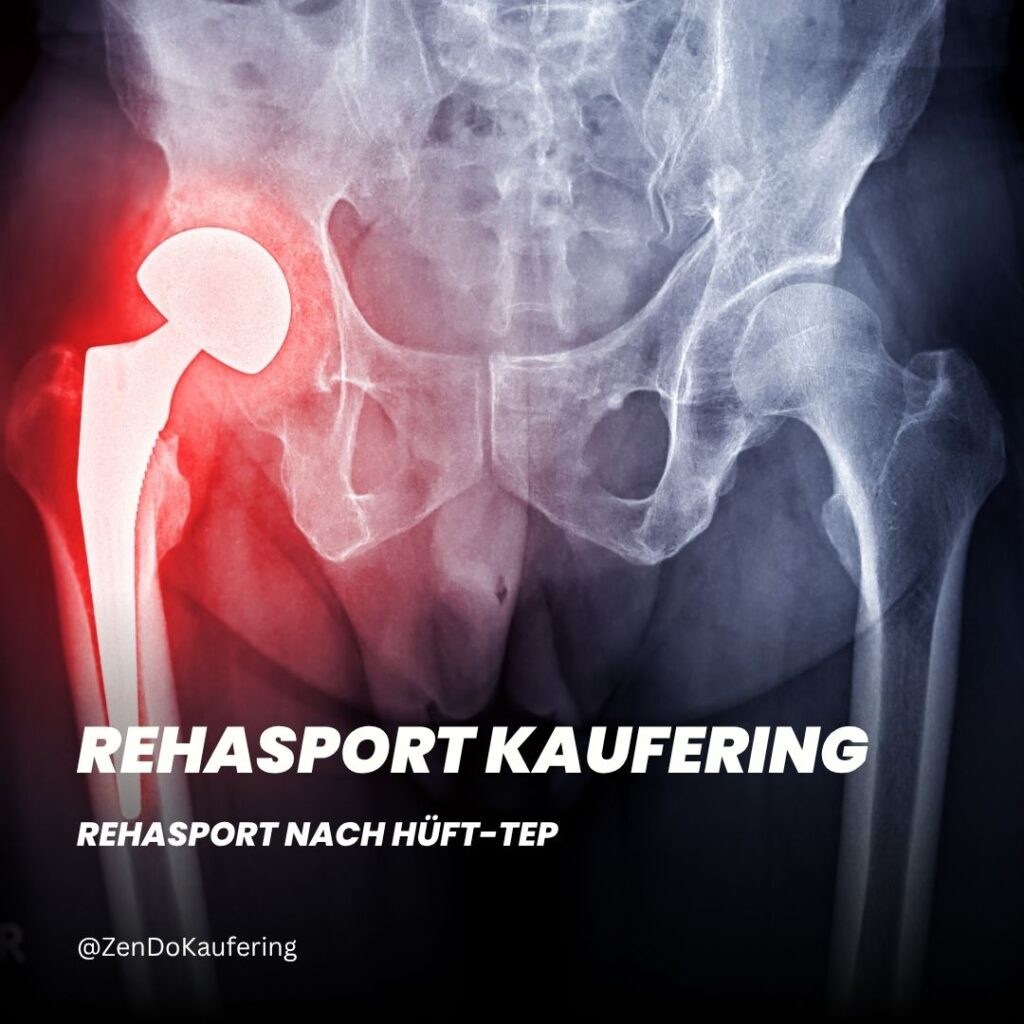 Rehasport in Kaufering - Rehasport nach Hüft-TEP